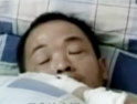 男子因财产问题与前妻争执被咬掉嘴唇