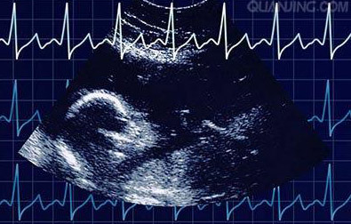 孕11周胎儿图片 b超图片